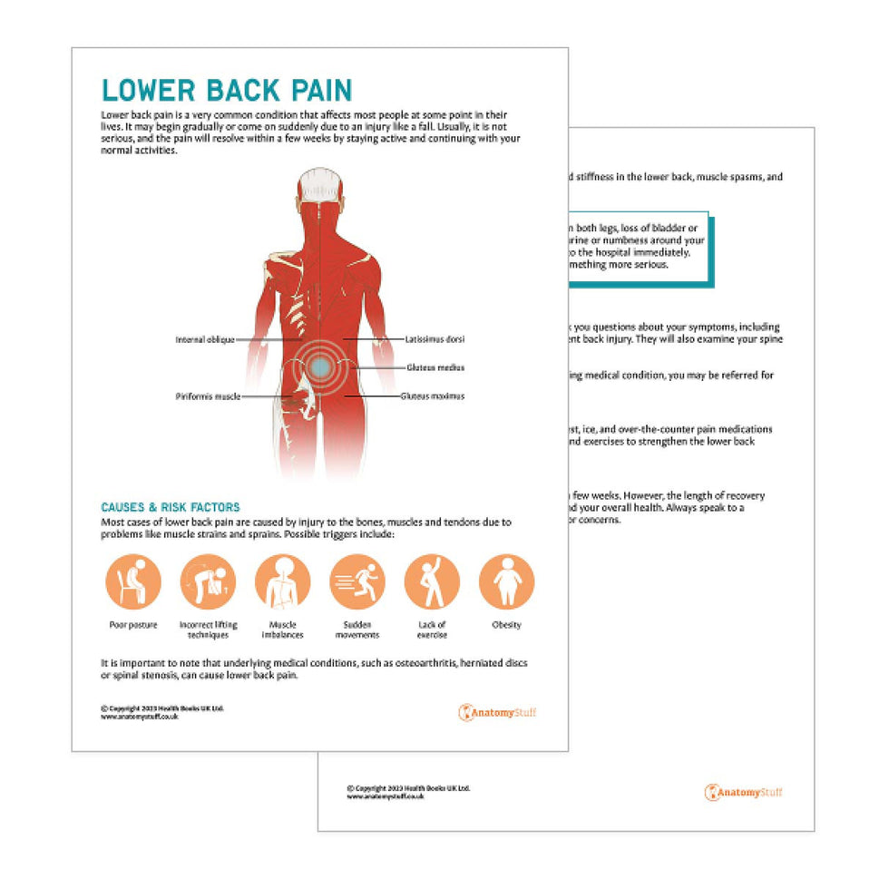 Lower Back Pain Patient Education Handout (Printable PDF)