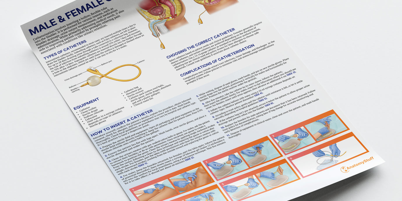 Before/after image 2