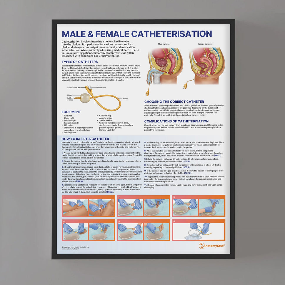 Male and Female Catheterisation Chart / Poster