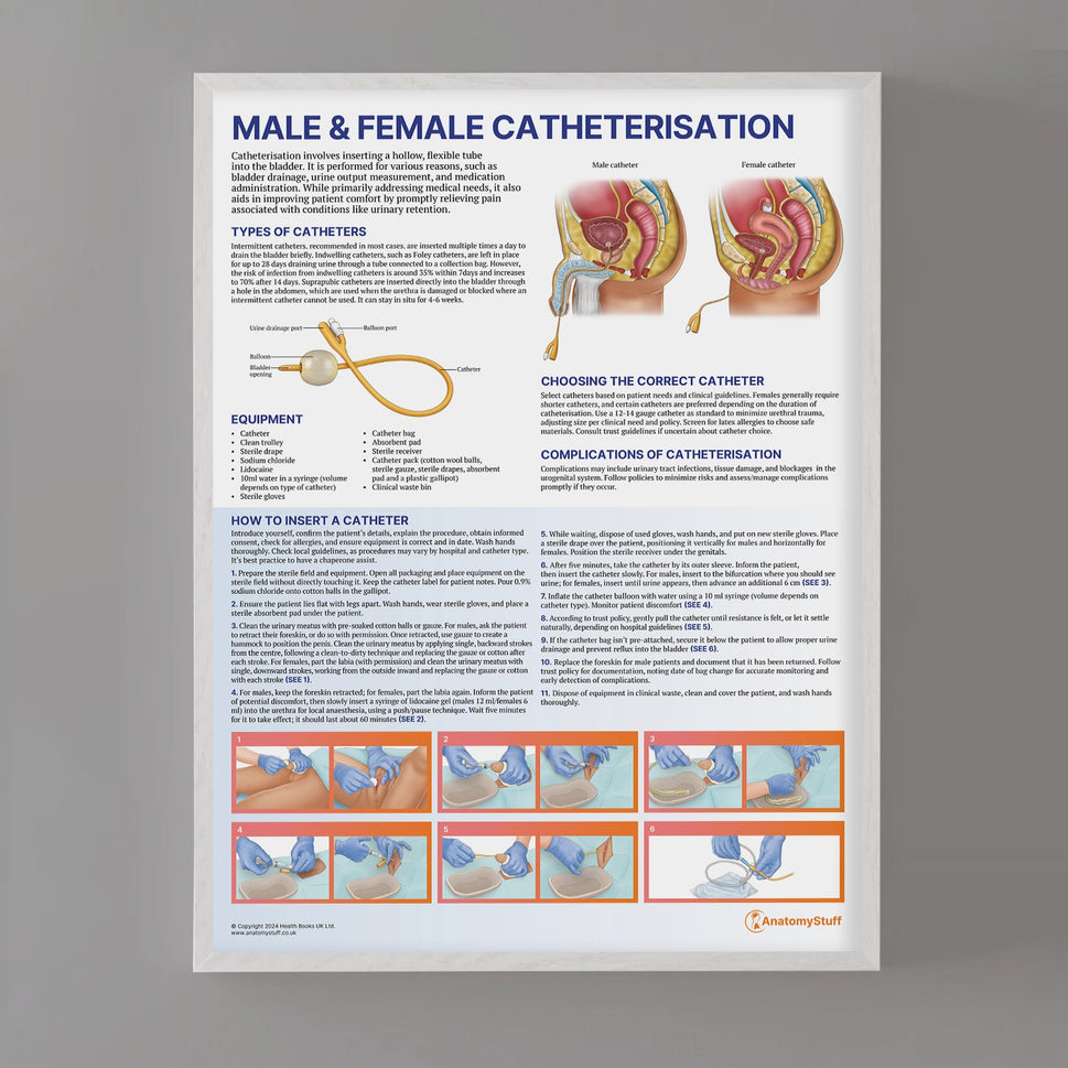 Male and Female Catheterisation Chart / Poster