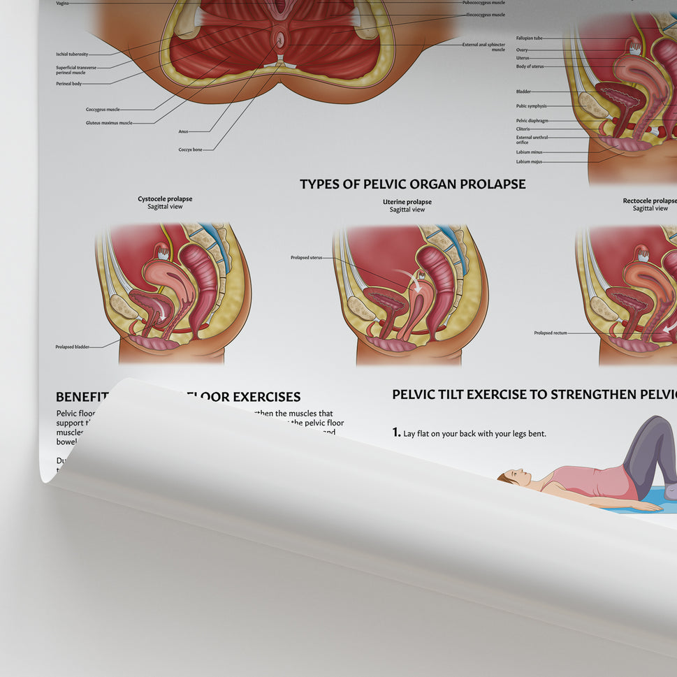 Pelvic Floor Anatomy Chart / Poster