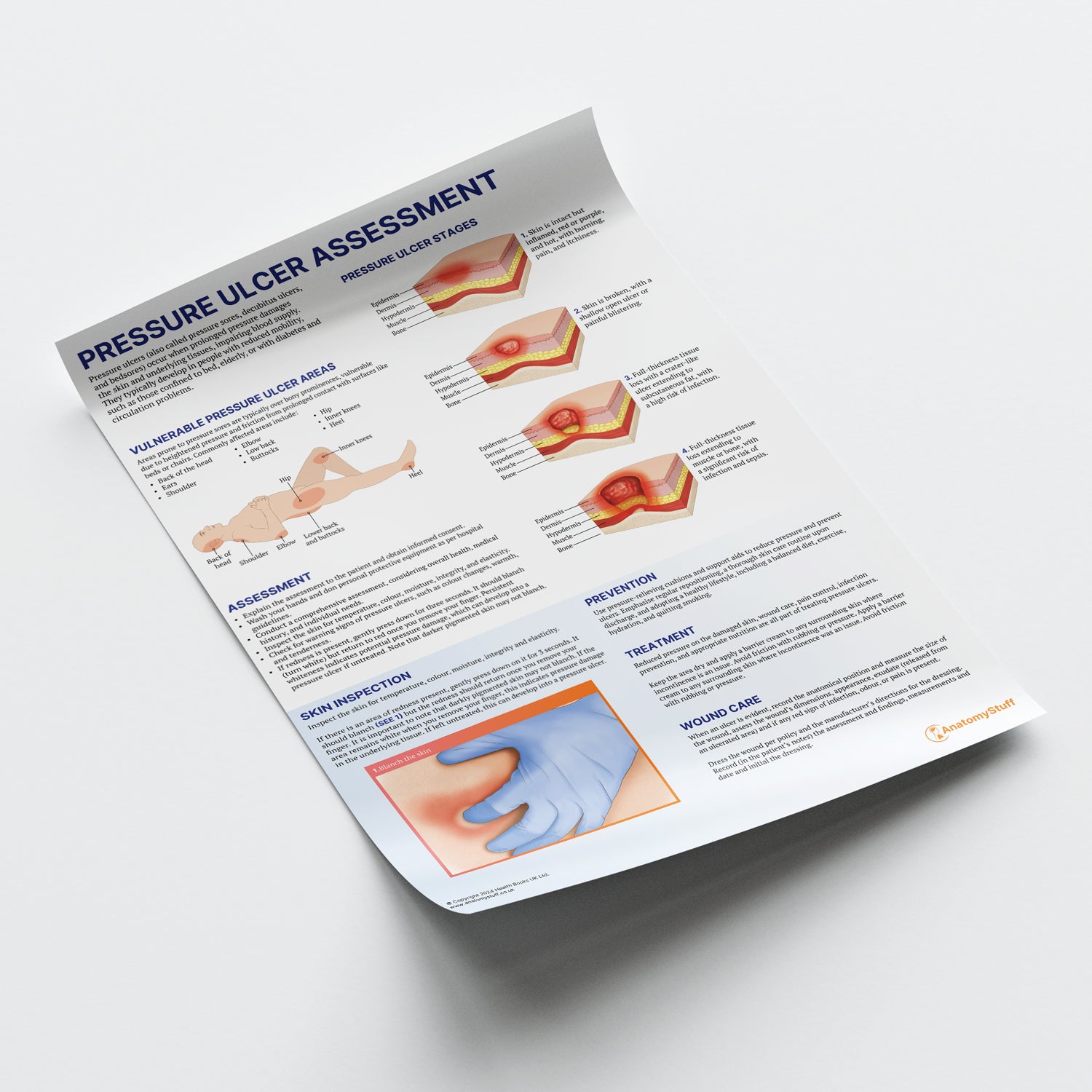 Pressure Ulcer Assessment and Care Chart / Poster