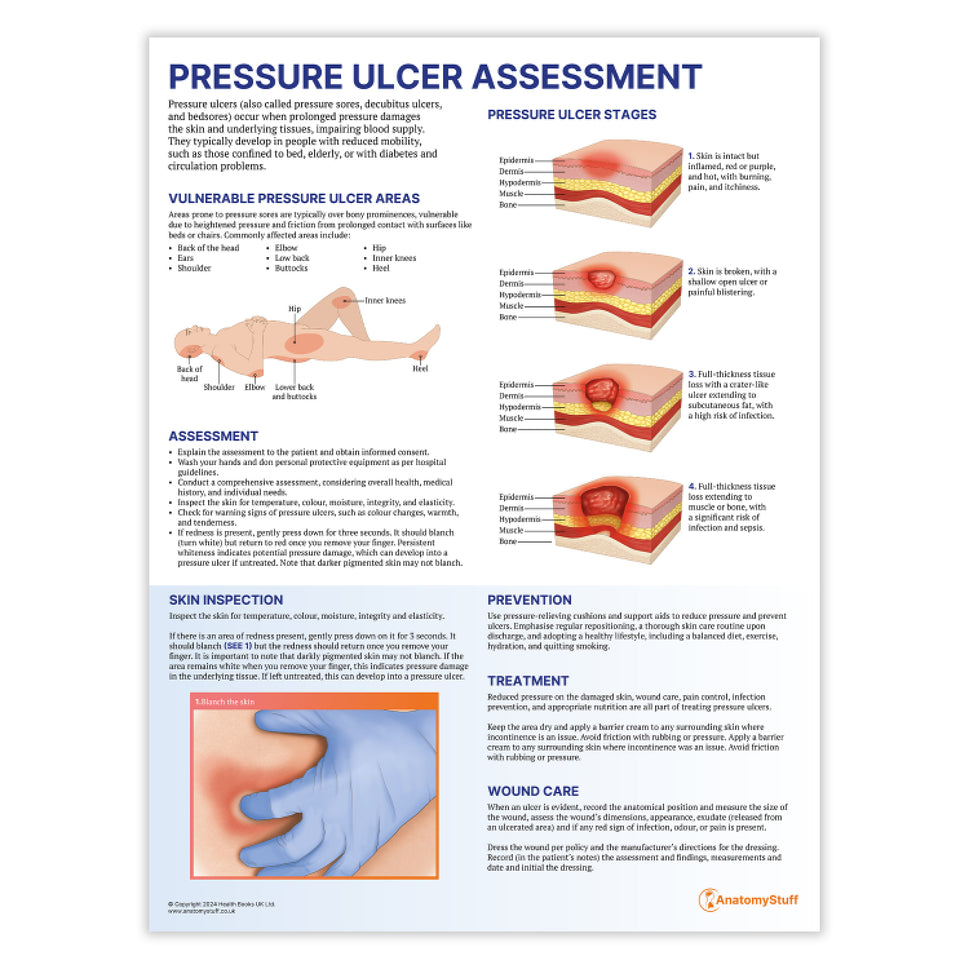 Pressure Ulcer Assessment and Care Chart / Poster