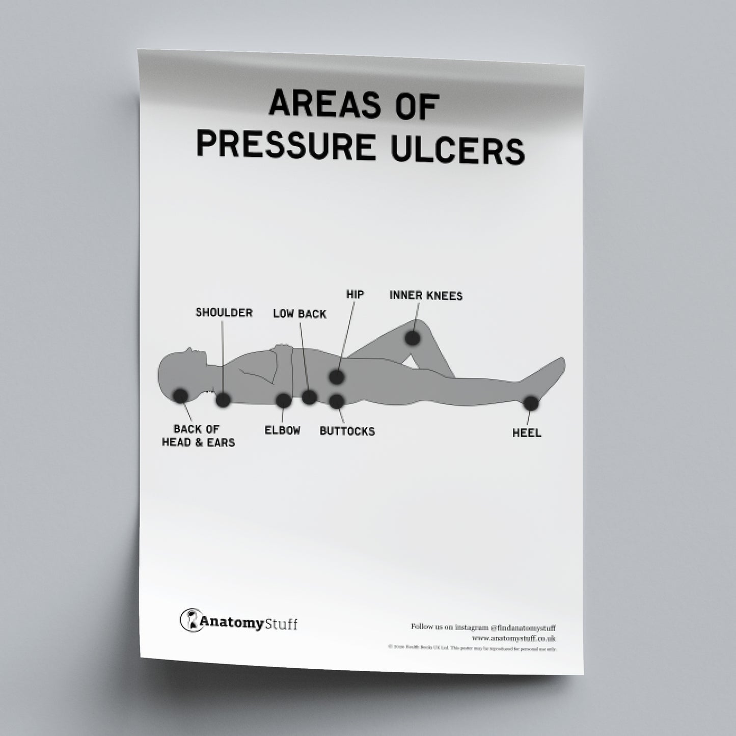 Pressure Ulcer Areas Poster PDF