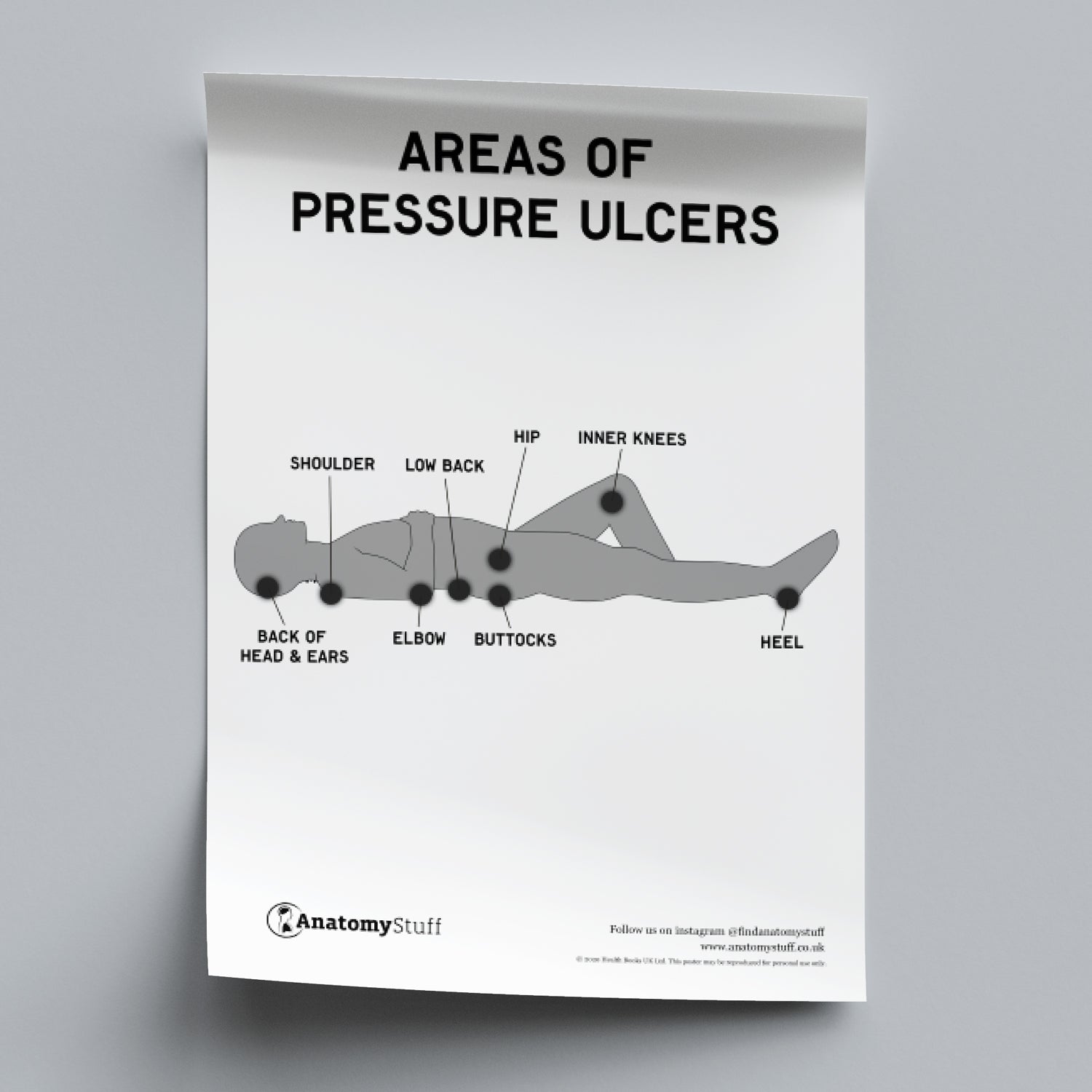 Pressure Ulcer Areas Poster PDF