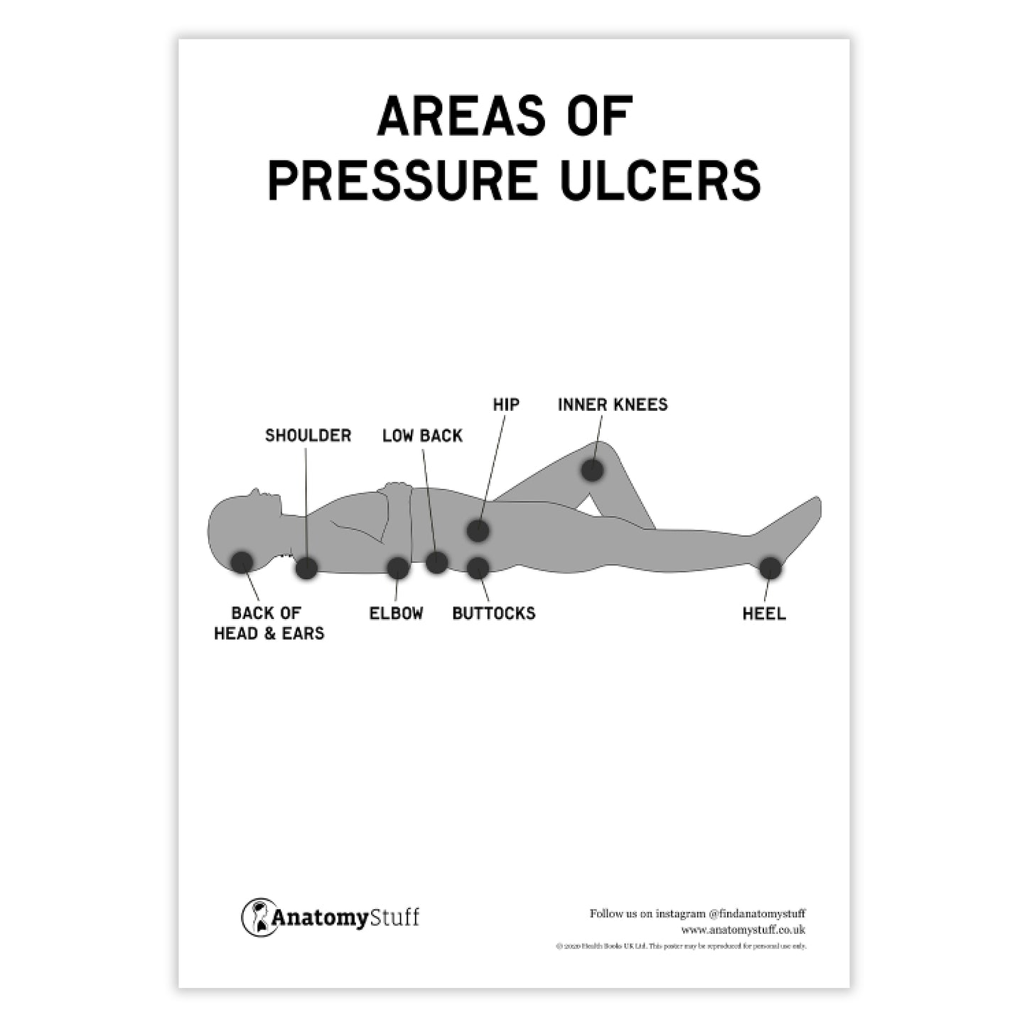 Pressure Ulcer Areas Poster PDF