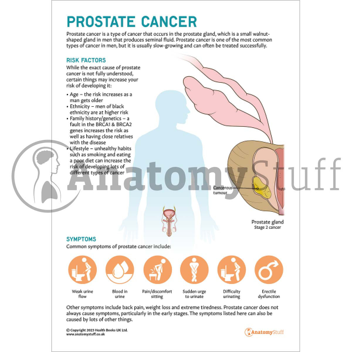 Prostate Cancer Patient Education Handout (Printable PDF)