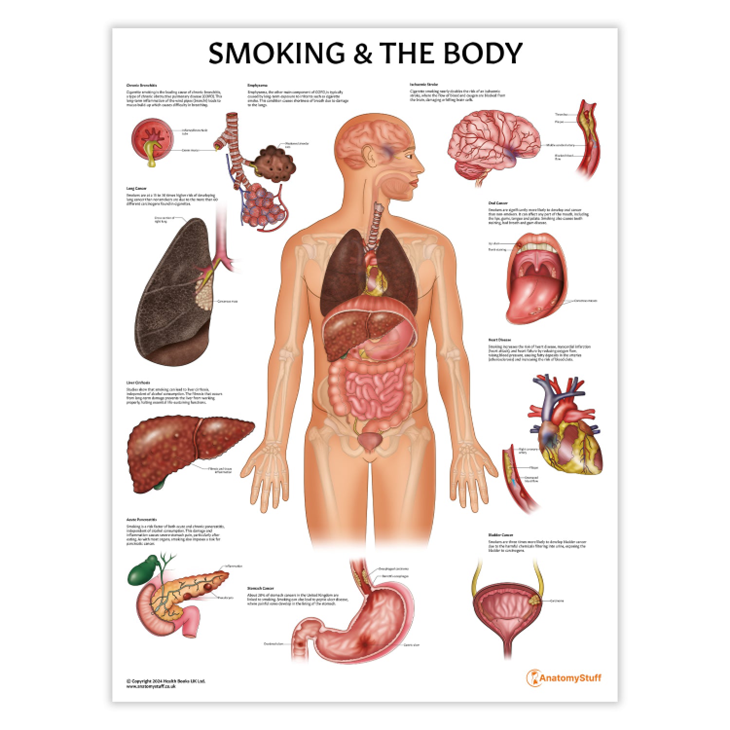 cigarettes and tobacco products Why Big Tobacco is Pushing States to Raise Smoking Ages cigarettes and tobacco products Why Big Tobacco is Pushing States to Raise Smoking Ages