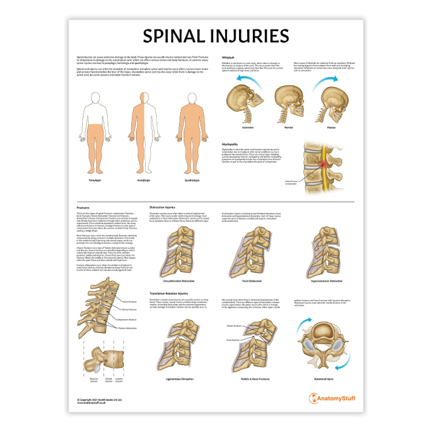 Spinal Injuries Chart / Poster