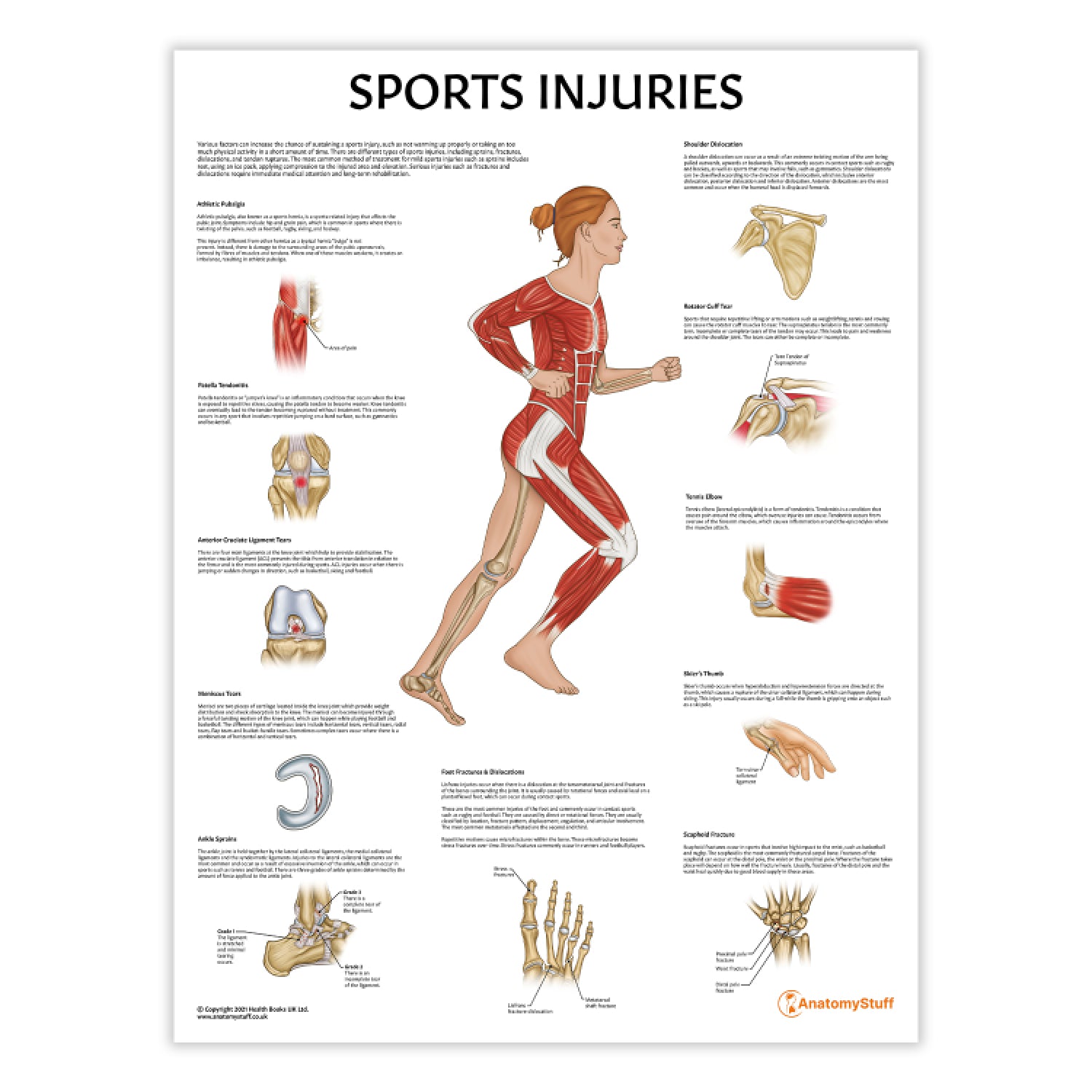 Sports Injuries Chart / Poster