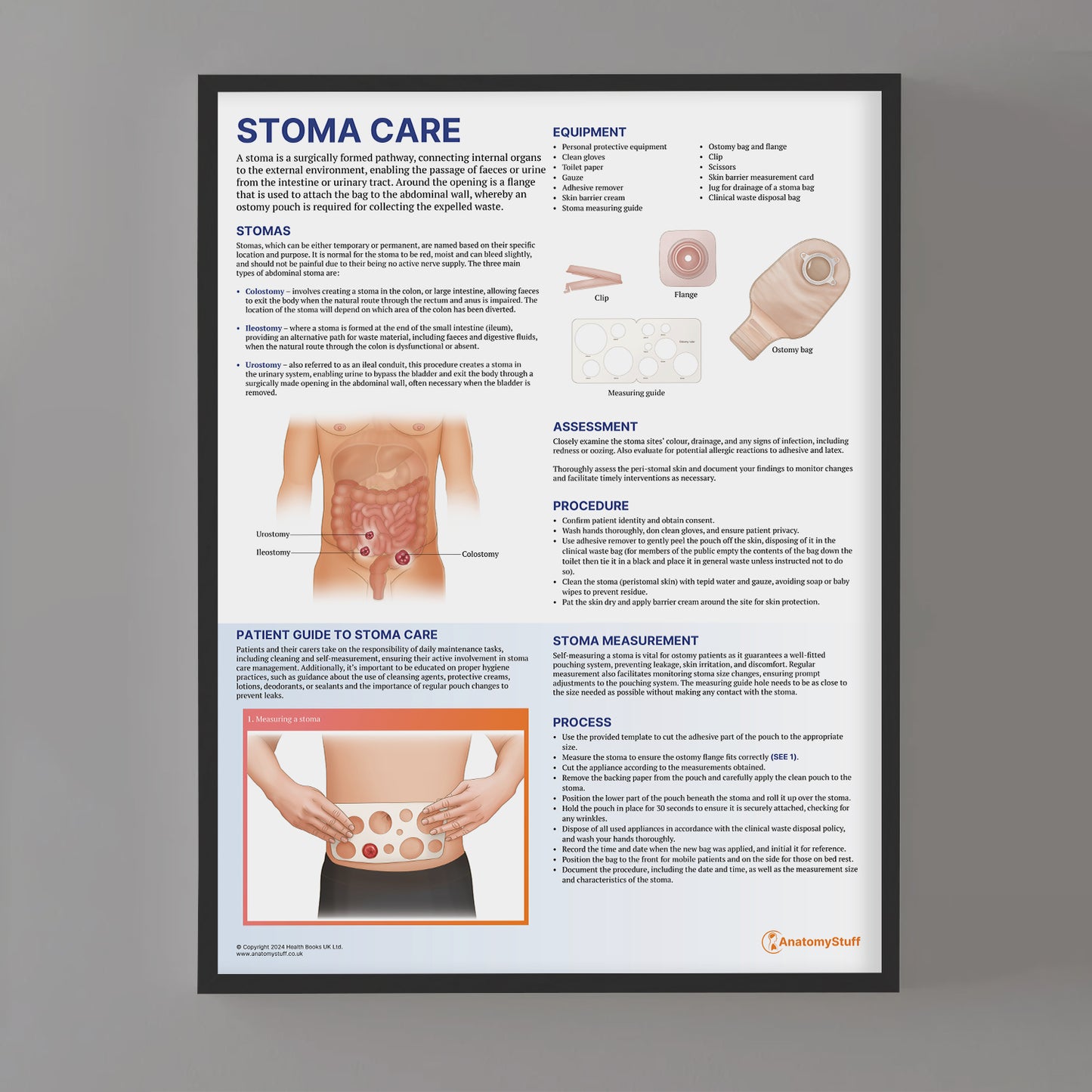 Stoma Care Chart / Poster