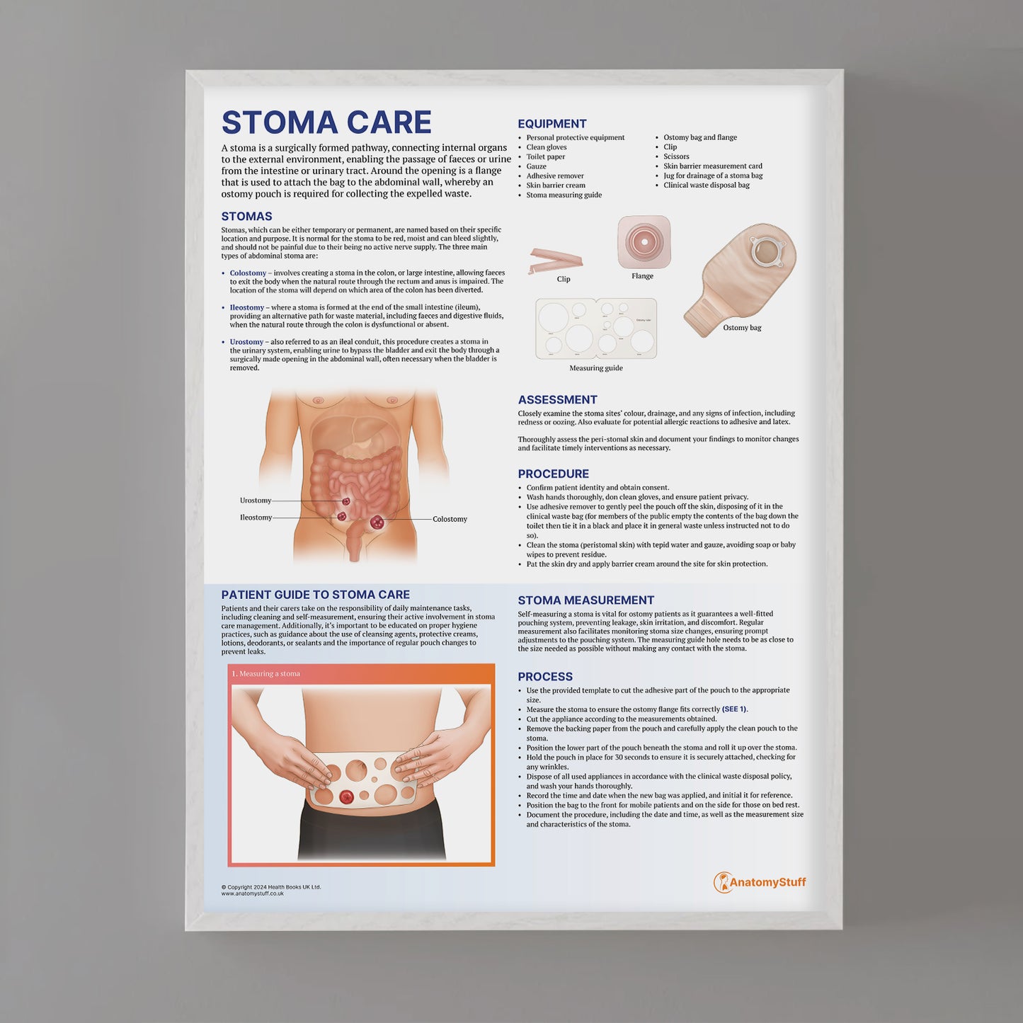 Stoma Care Chart / Poster