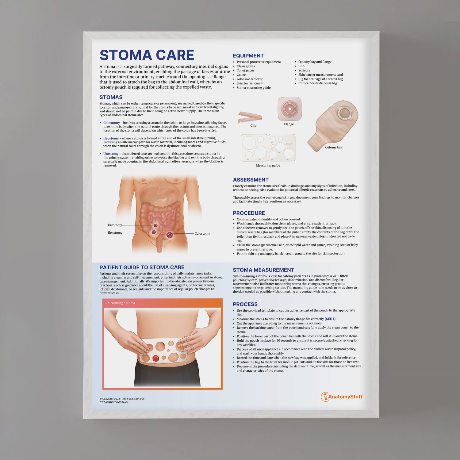 Stoma Care Chart / Poster