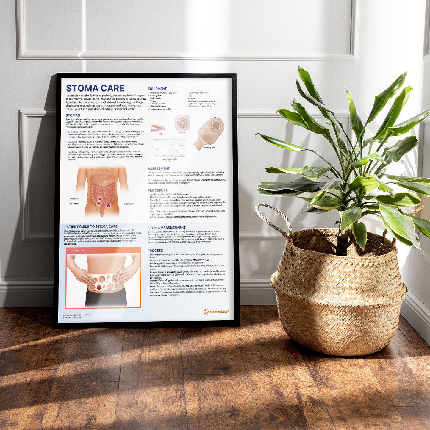 Stoma Care Chart / Poster