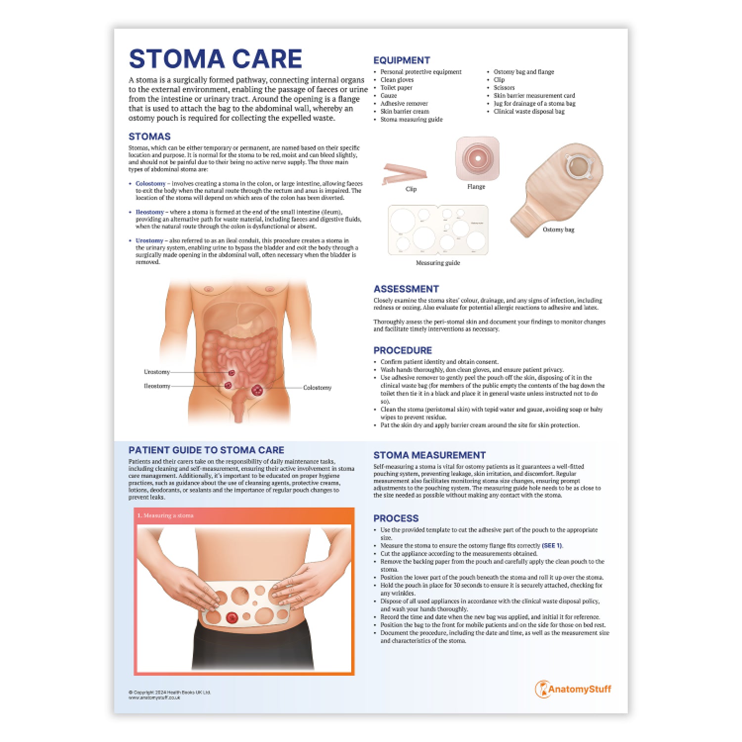 Stoma Care Chart / Poster