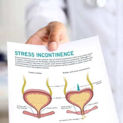 Stress Incontinence Patient Education Handout (Printable PDF)