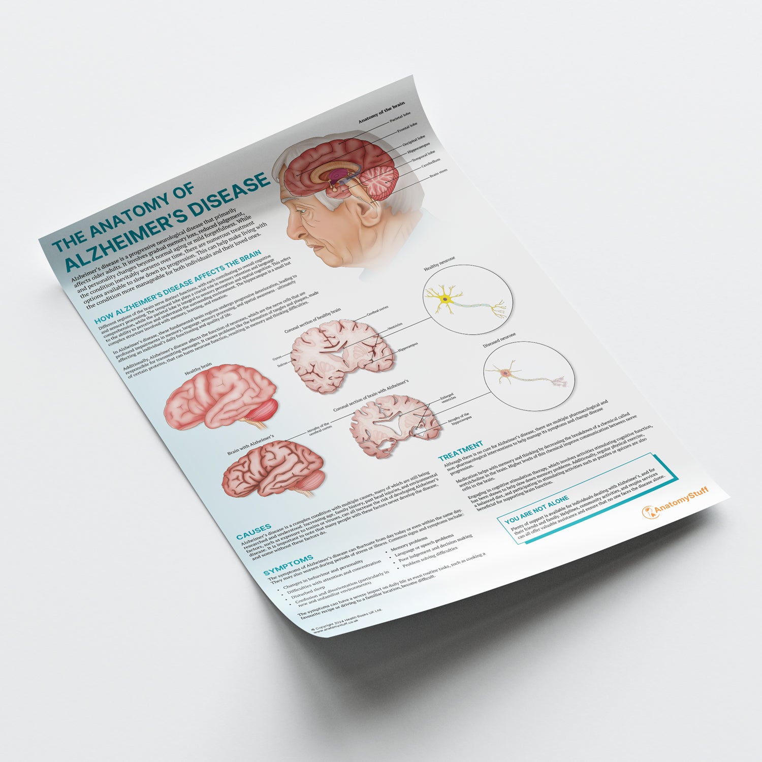 The Anatomy of Alzheimer's Disease Chart / Poster