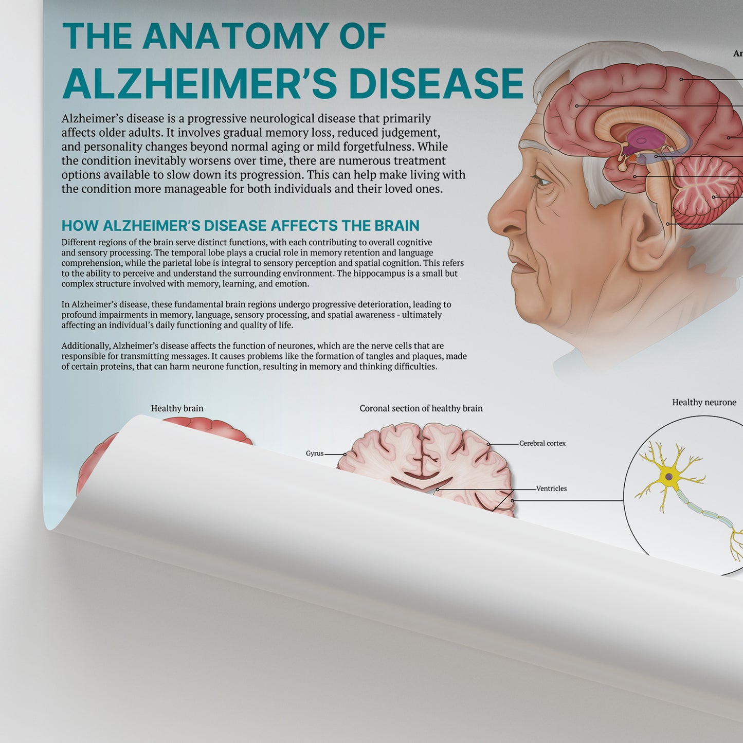 The Anatomy of Alzheimer's Disease Chart / Poster