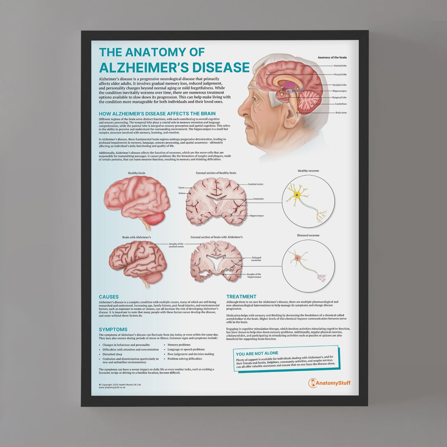 The Anatomy of Alzheimer's Disease Chart / Poster