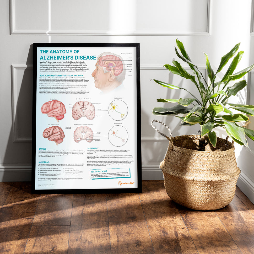 The Anatomy of Alzheimer's Disease Chart / Poster