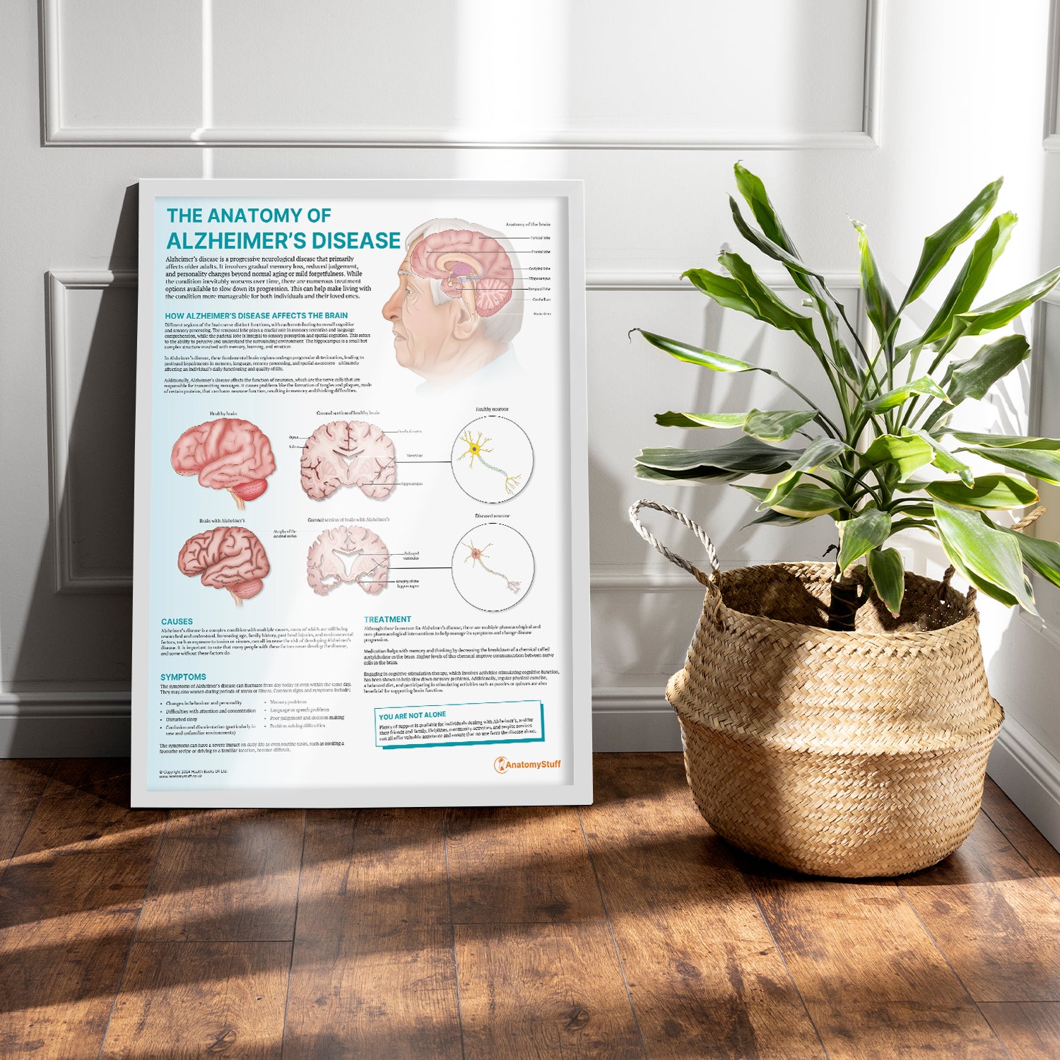 The Anatomy of Alzheimer's Disease Chart / Poster