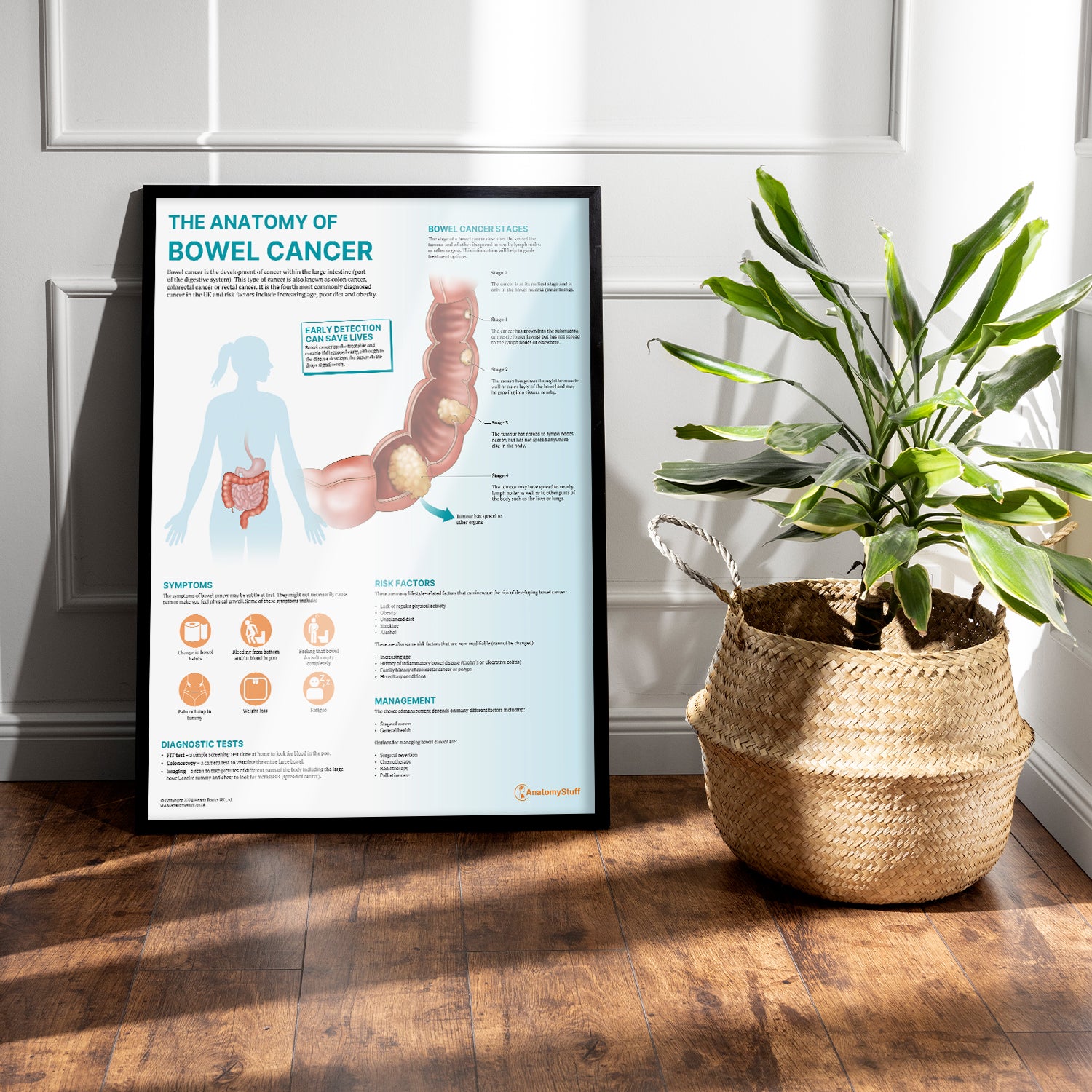 The Anatomy of Bowel Cancer Chart / Poster