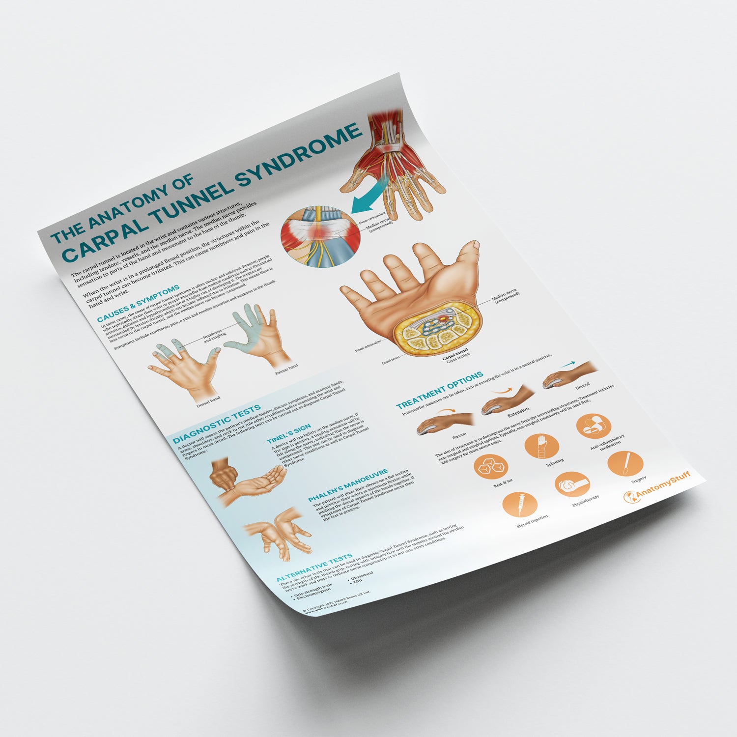 The Anatomy of Carpal Tunnel Syndrome Chart / Poster
