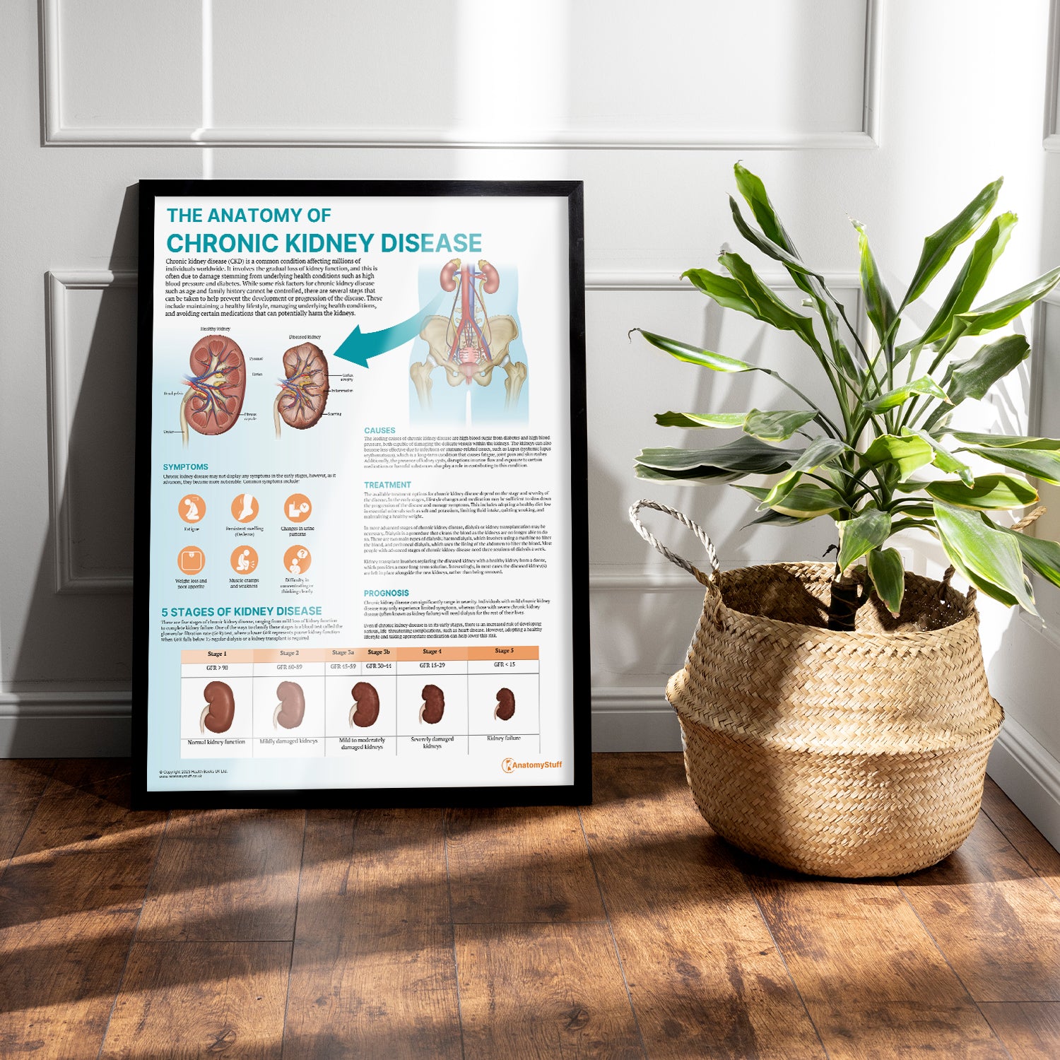 The Anatomy of Chronic Kidney Disease Chart / Poster