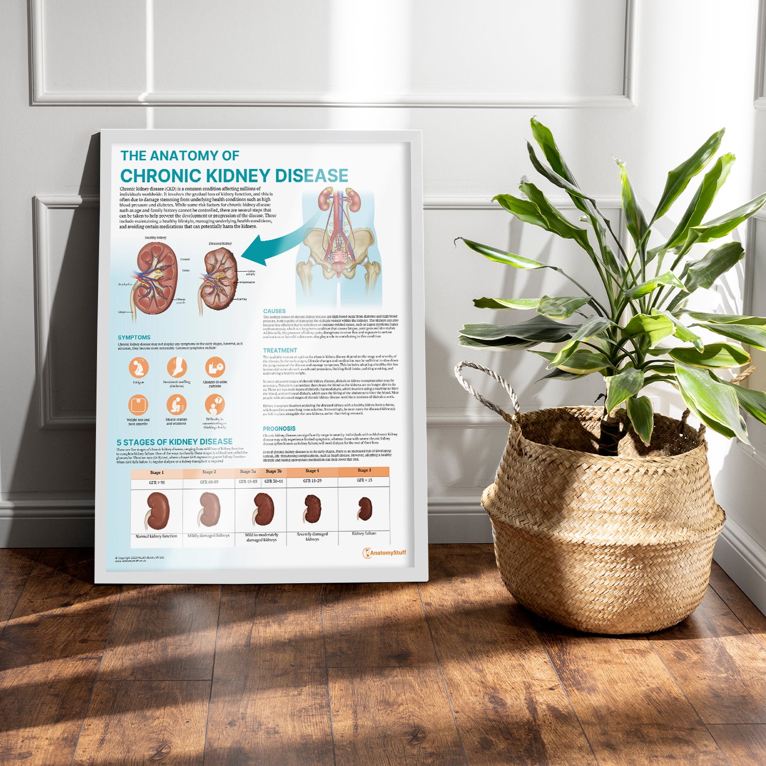 The Anatomy of Chronic Kidney Disease Chart / Poster