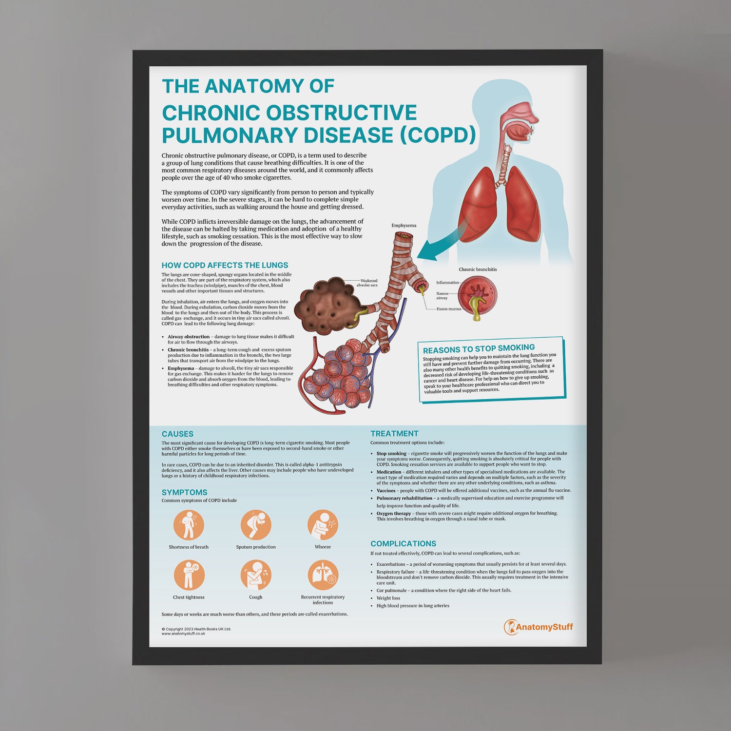 The Anatomy of COPD Chart / Poster