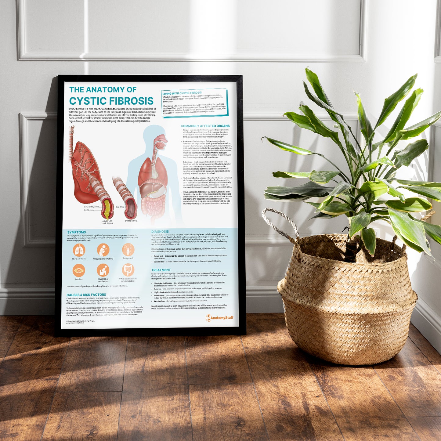 The Anatomy of Cystic Fibrosis Chart / Poster