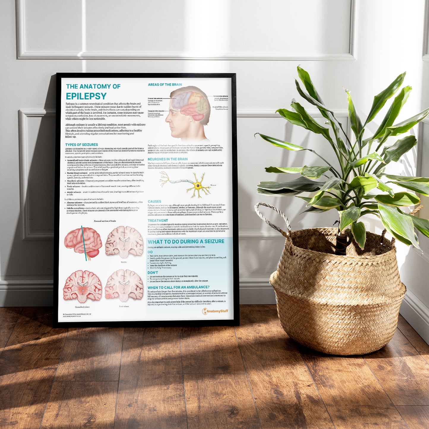 The Anatomy of Epilepsy Chart / Poster