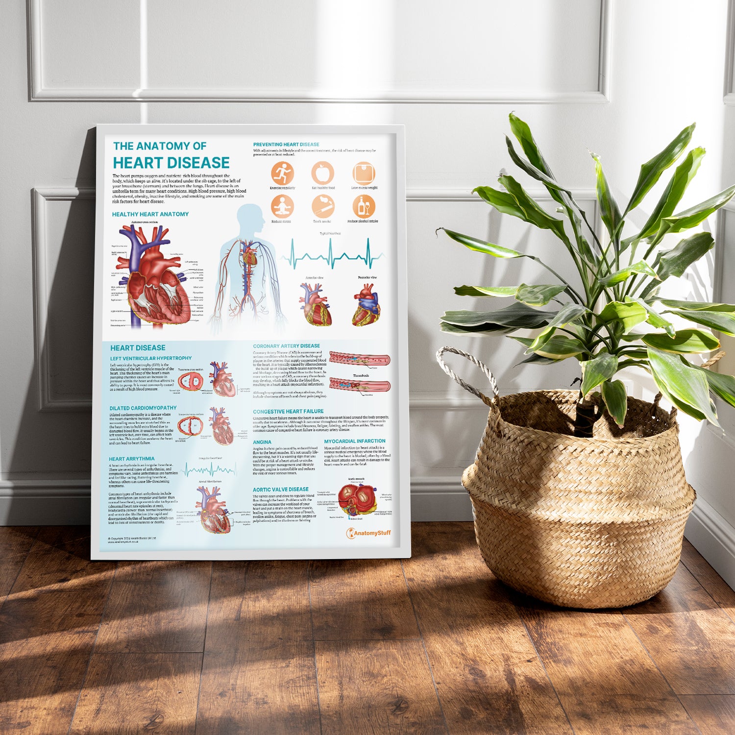 The Anatomy of Heart Disease Chart / Poster
