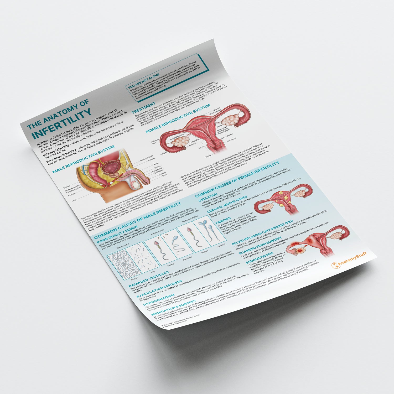 The Anatomy of Infertility Chart / Poster