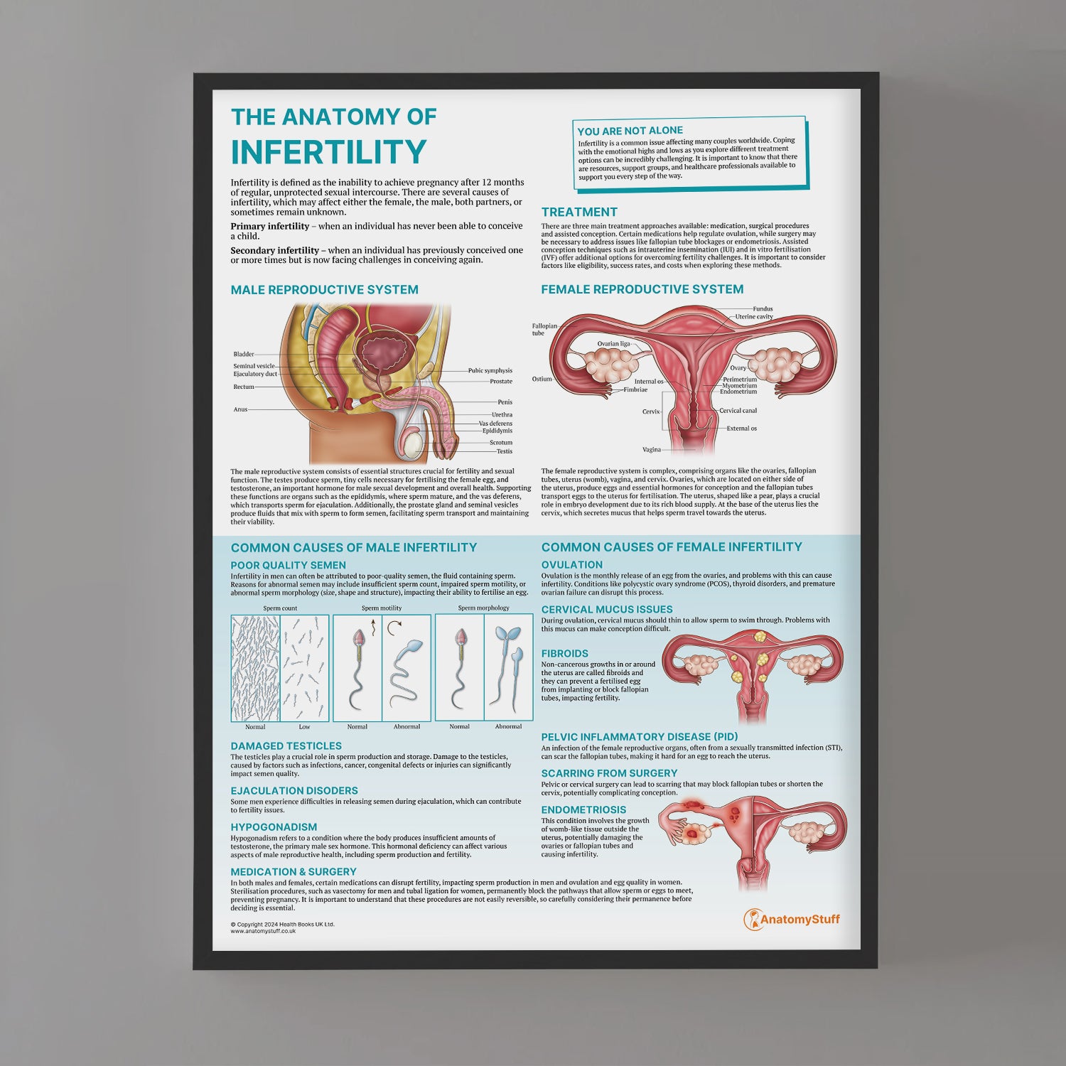 The Anatomy of Infertility Chart / Poster