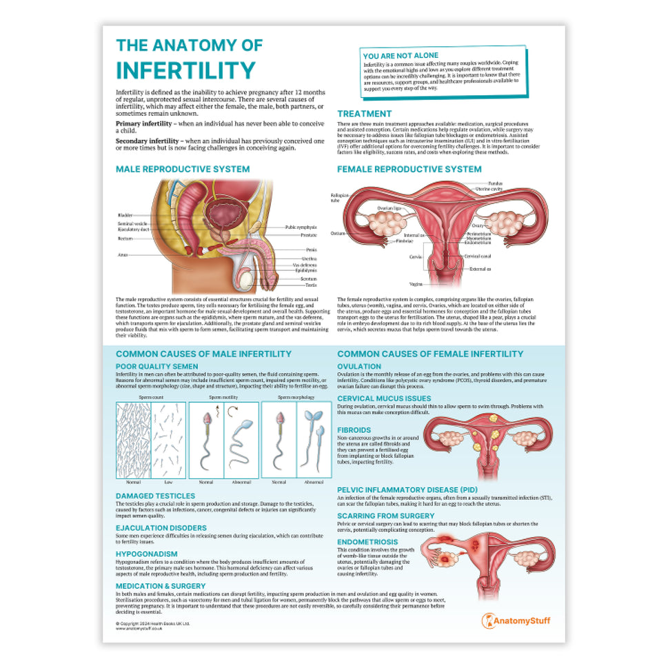 The Anatomy of Infertility Chart / Poster