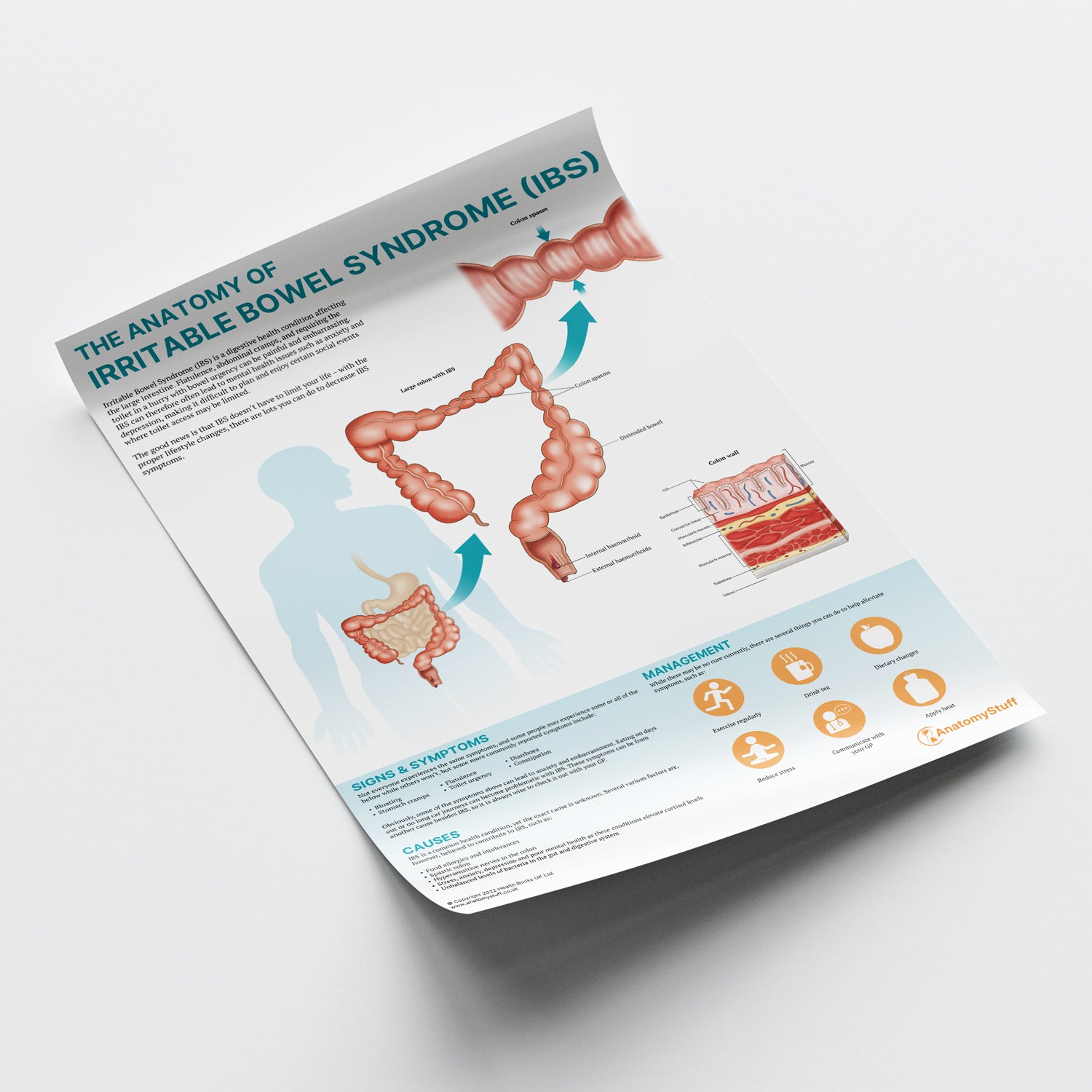 The Anatomy of Irritable Bowel Syndrome (IBS) Chart / Poster