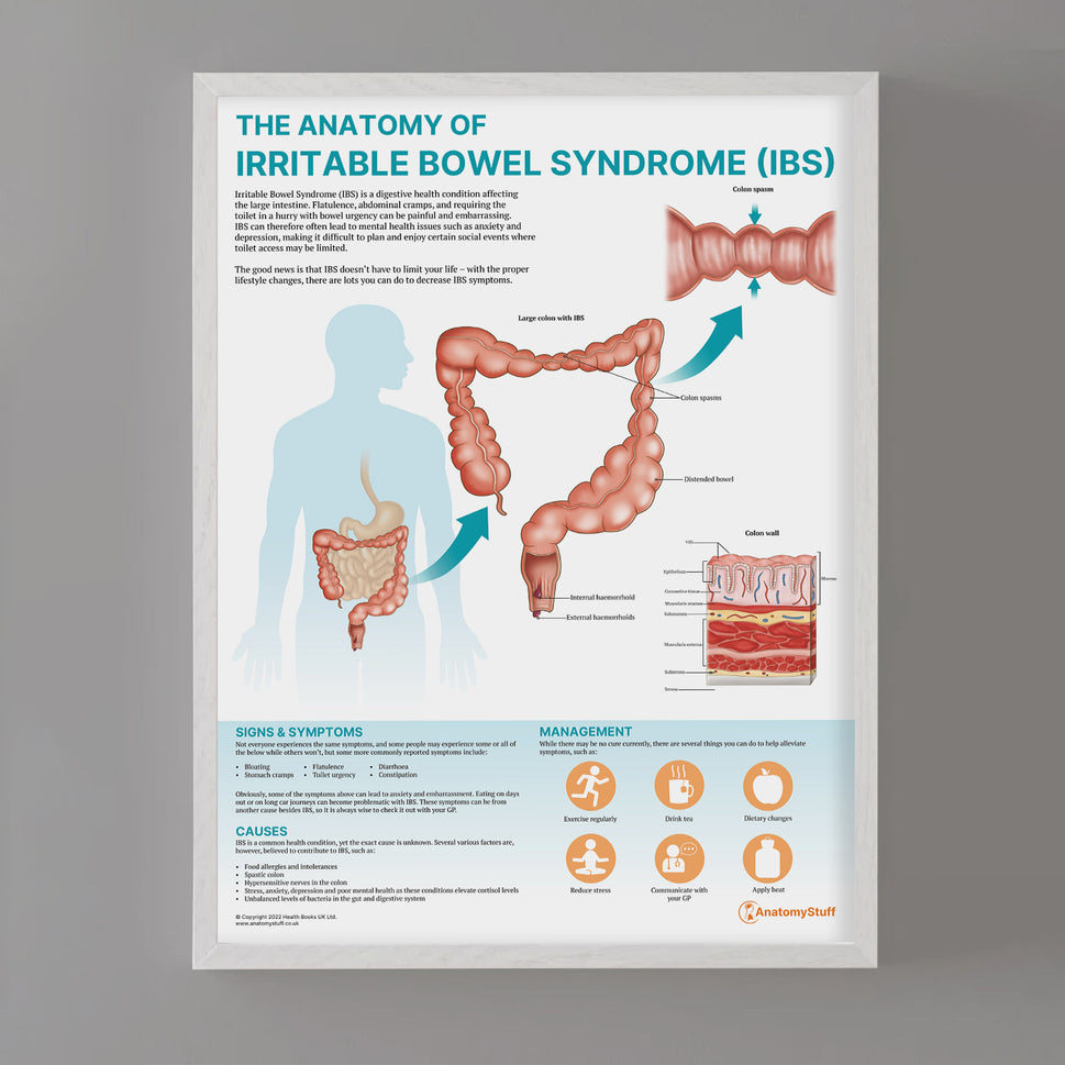 The Anatomy of Irritable Bowel Syndrome (IBS) Chart / Poster