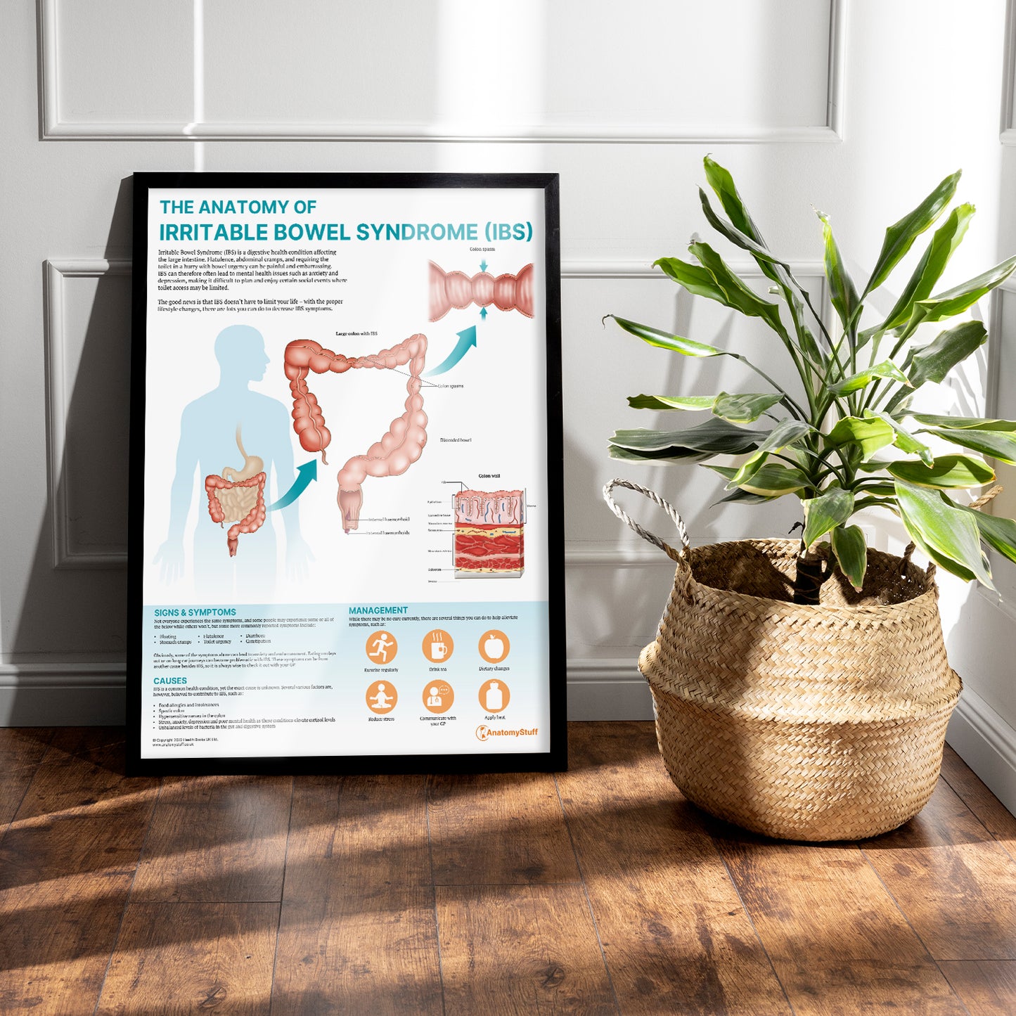 The Anatomy of Irritable Bowel Syndrome (IBS) Chart / Poster