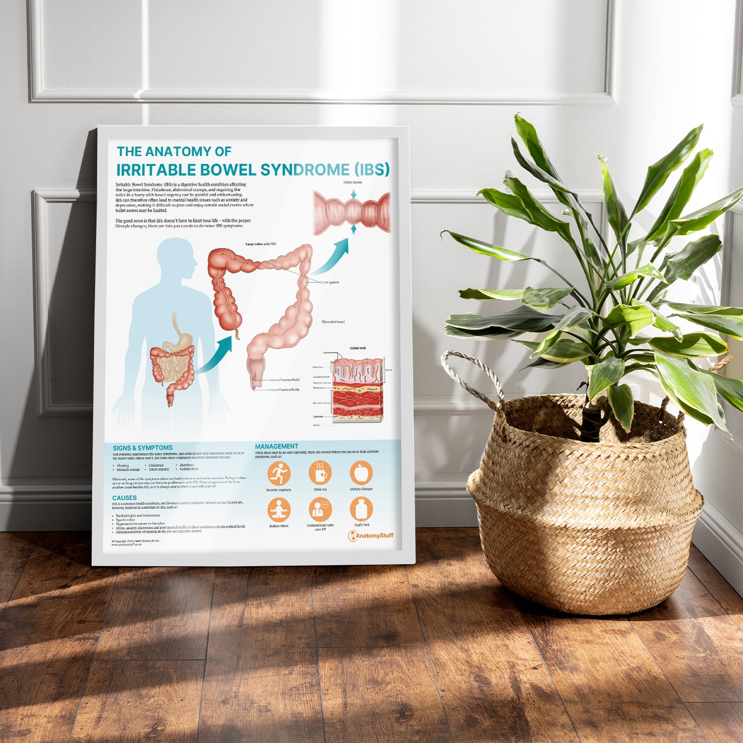 The Anatomy of Irritable Bowel Syndrome (IBS) Chart / Poster