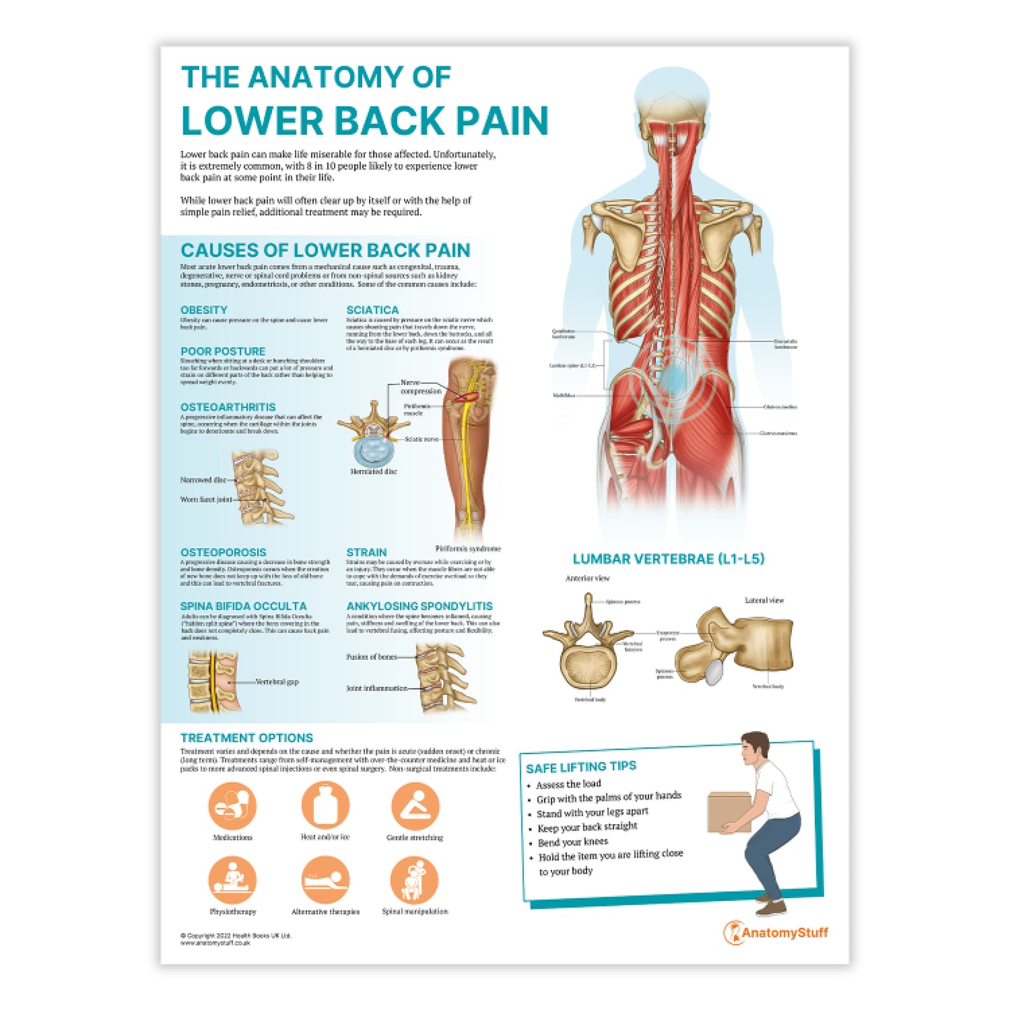 The Anatomy of Lower Back Pain Chart / Poster