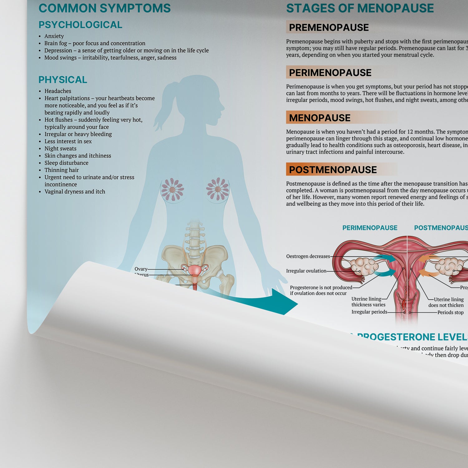<strong>The Anatomy of Menopause Chart </strong>
