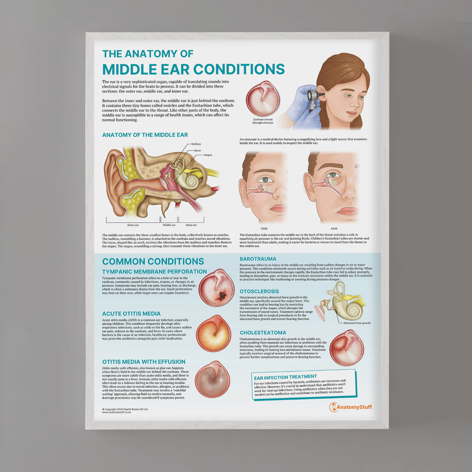 The Anatomy of Middle Ear Conditions Chart / Poster