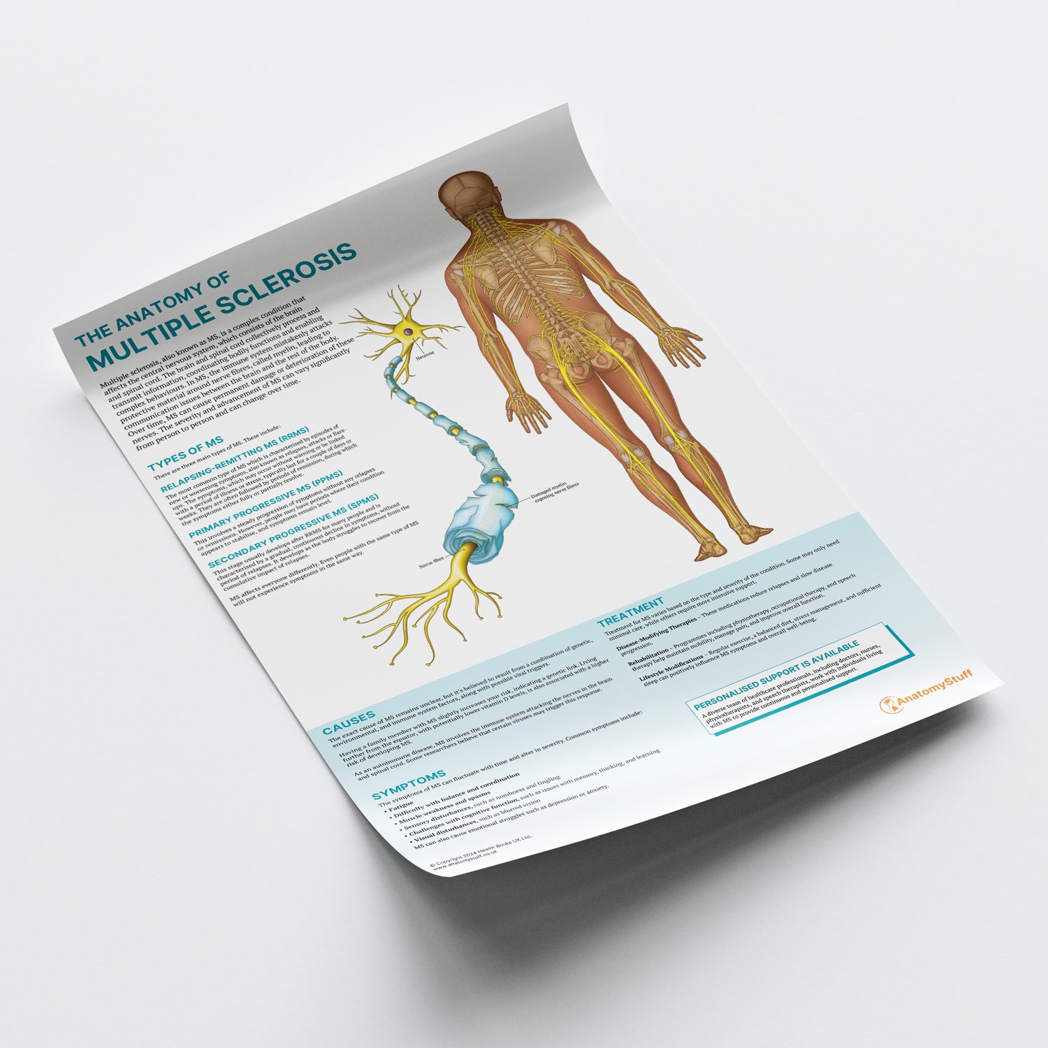 The Anatomy of Multiple Sclerosis Chart / Poster