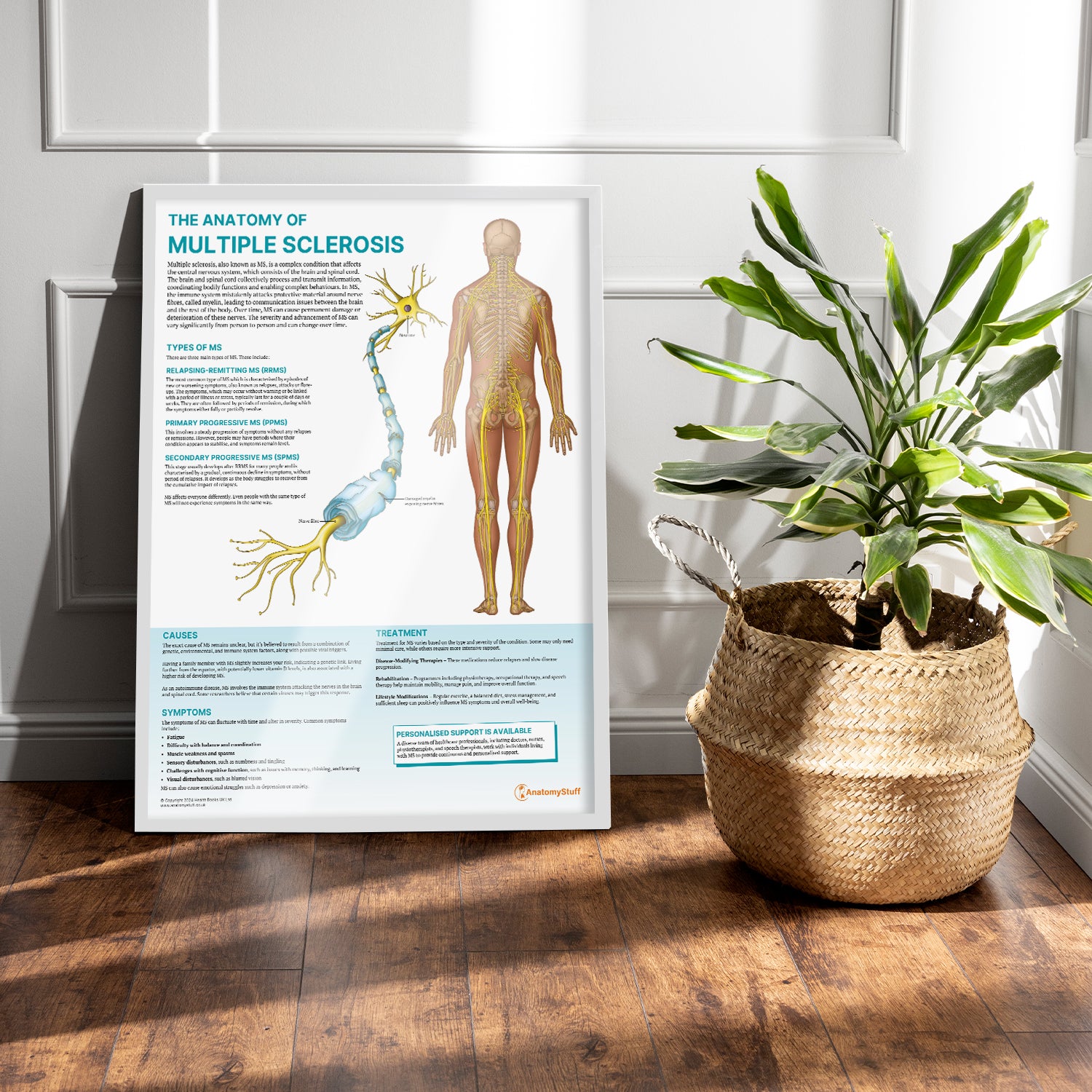 The Anatomy of Multiple Sclerosis Chart / Poster