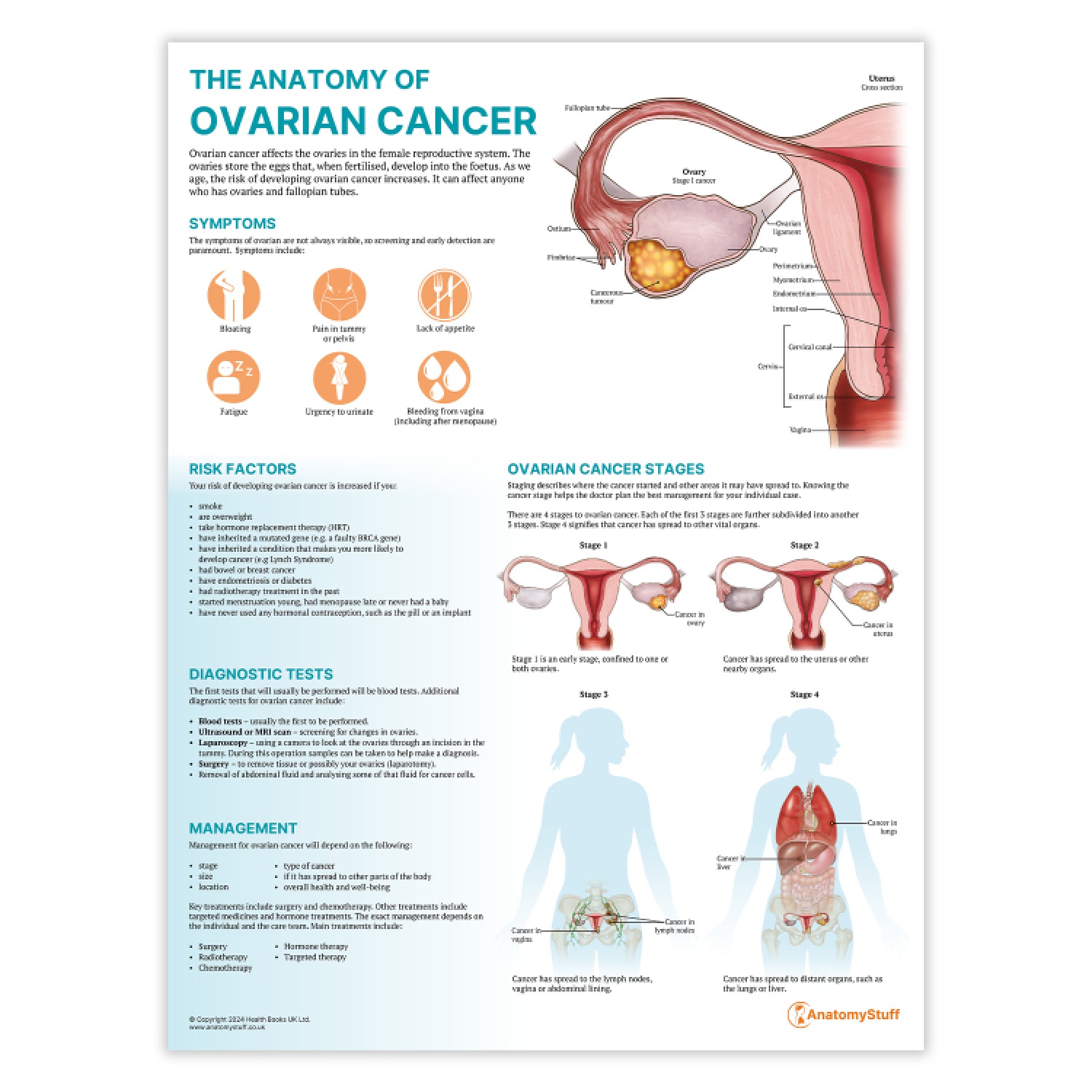 <strong>The Anatomy of Ovarian Cancer Chart</strong>