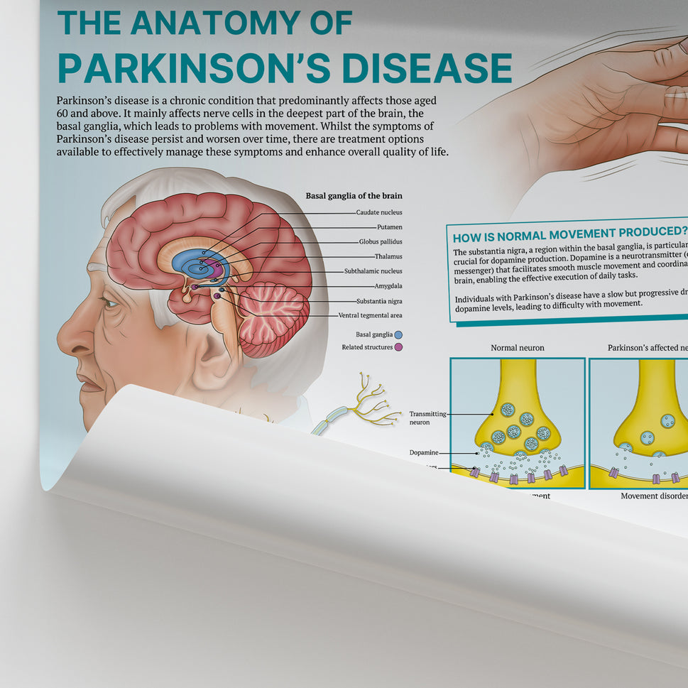 The Anatomy of Parkinson's Disease Chart / Poster