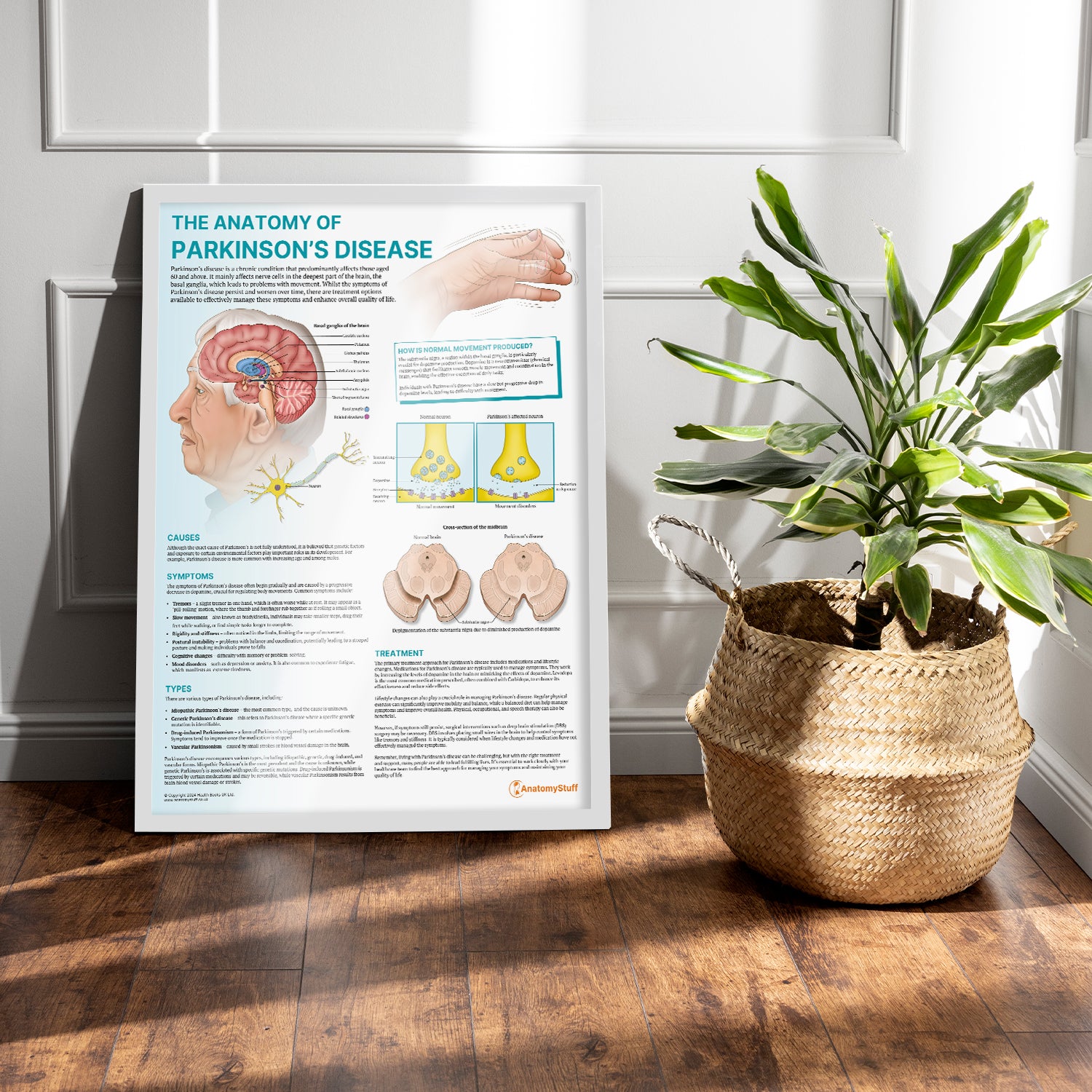 The Anatomy of Parkinson's Disease Chart / Poster