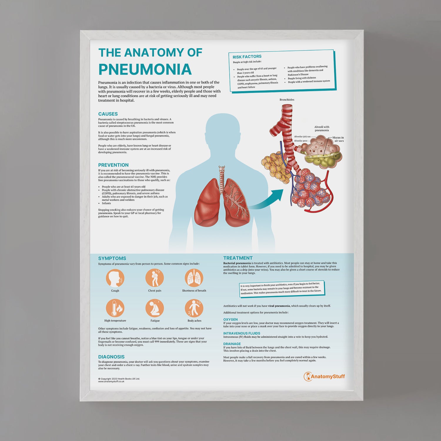 The Anatomy of Pneumonia Chart / Poster