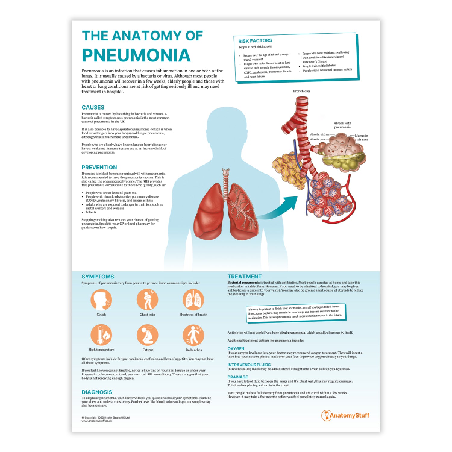 The Anatomy of Pneumonia Chart / Poster